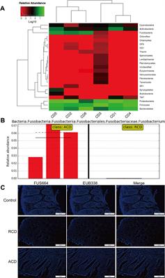 Fusobacterium nucleatum Activates Endoplasmic Reticulum Stress to Promote Crohn’s Disease Development via the Upregulation of CARD3 Expression